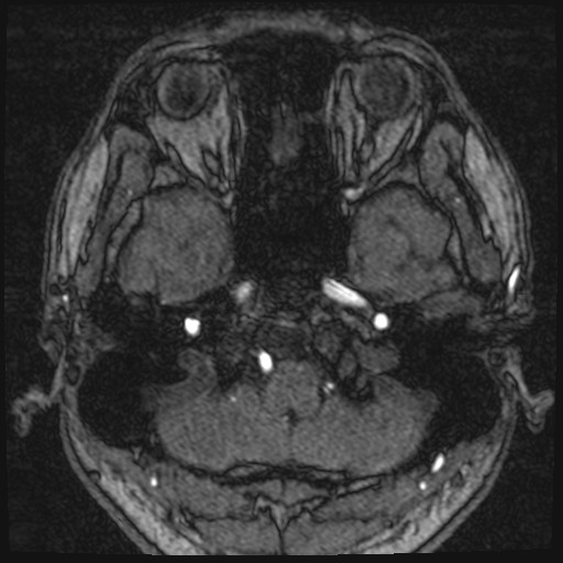 Click on the Serie image to view the images of VILLANUEVA, WILLIAM A.